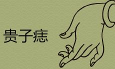 绝对准确!揭秘命中有贵子的痣所在的身体部位!