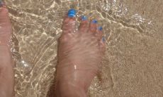 脚趾外翻会导致女性命运不佳的说法是否具备科学依据？