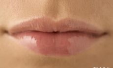 女性嘴周右下方的痣的解析:揭秘痣的位置和特征与女性命运的关系