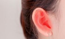 详细揭示女性耳朵上各类痣图解及位置,你知道耳朵上有哪些痣吗?