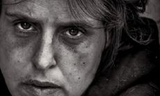 通过面相疤痕图解探讨:破相之人必具备较为显著的面相特征