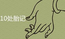 在身体的10个部位上都长着福气之神——胎记