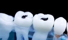 女人梦见自己失去4颗牙齿会对健康产生威胁吗? 梦境与生理的关联性何在?