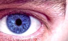 右眉毛上有疤的人是否注定大富大贵?