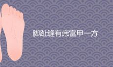 脚趾缝有痣富甲一方真的吗 脚上痣相图解