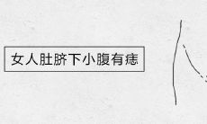 女人肚脐下小腹有痣