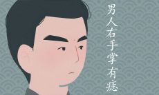 男右手掌有痣图解大全 有富贵命的痣相