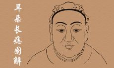 耳朵上长痣图解命运吉凶