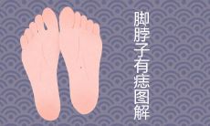 脚脖子有痣图解详细介绍