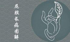 屁股不同位置痣图解大全