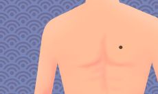 黑痣的位置和命运图解分析 哪里长痣最好