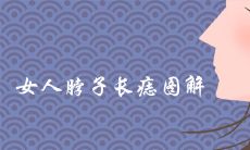女人脖子上的痣全图解大全