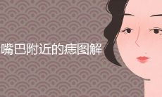 嘴巴附近的痣图解大全 脸上哪里长痣大富大贵