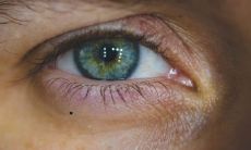 穷痣长在哪 哪里长痣将来会巨富