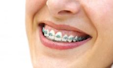 上嘴唇薄的人好不好 嘴唇薄厚类型分析