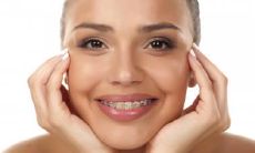 嘴角下长痣好不好 痣长在嘴巴哪里好